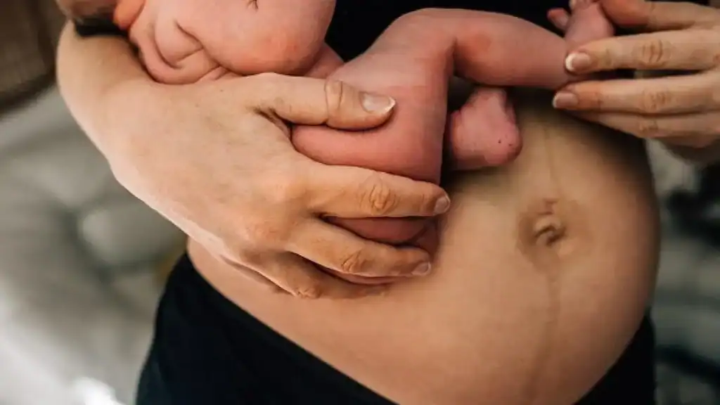 Why Is My Stomach Still Big After Pregnancy Salford?